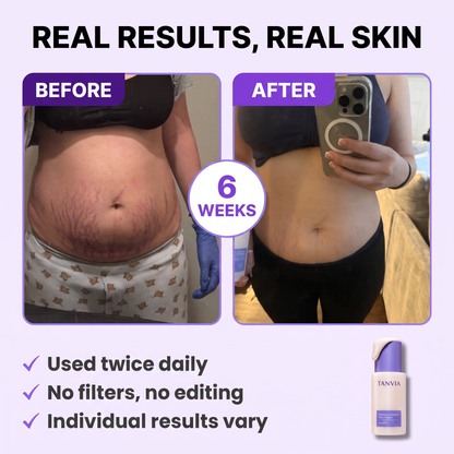 Tighten & Smooth Belly Firming Cream
